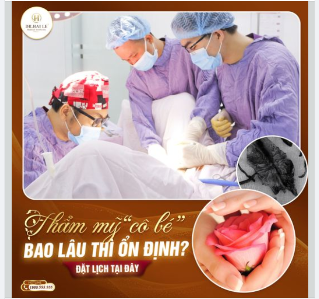 Thẩm mỹ cô bé bao lâu thì ổn định