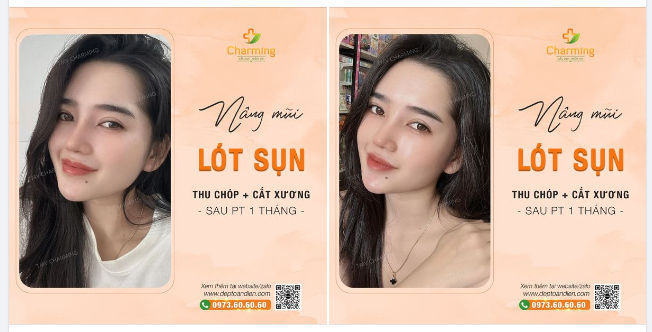 Nhìn nàng cười mà Charming cũng thấy hạnh phúc, tự hào theo luôn