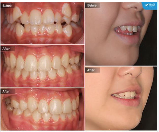 MỘT NỤ CƯỜI KHOẺ MẠNH VÀ THẨM MỸ CÓ THỂ NÂNG CAO CHẤT LƯỢNG CUỘC SỐNG!