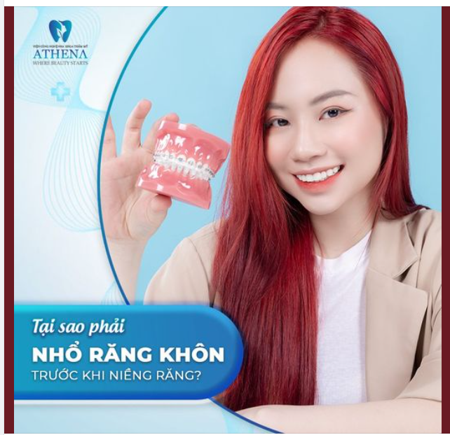 TẠI SAO PHẢI NHỔ RĂNG KHÔN TRƯỚC KHI NIỀNG RĂNG