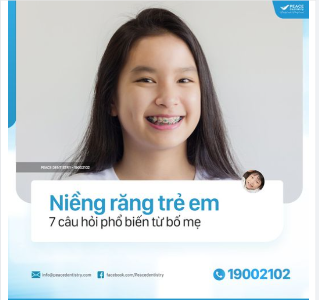 NIỀNG RĂNG TRẺ EM: GIẢI ĐÁP 7 CÂU HỎI PHỔ BIẾN NHẤT TỪ PHỤ HUYNH