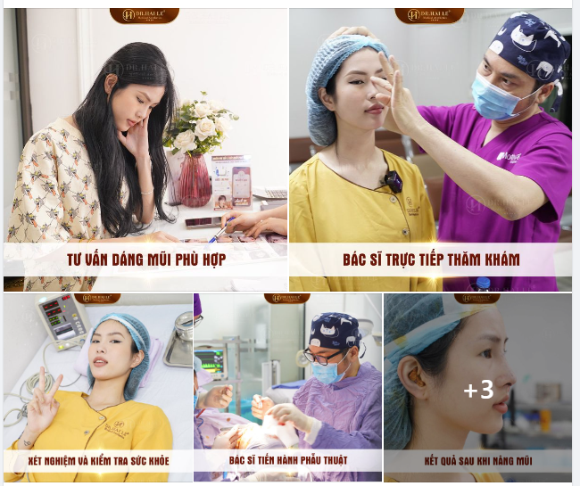 Quy trình nâng mũi tại Dr.Hải Lê 