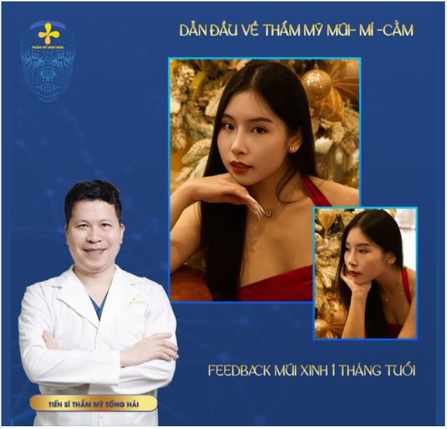 FEEDBACK MŨI XINH CỰC PHẨM SAU 1 THÁNG