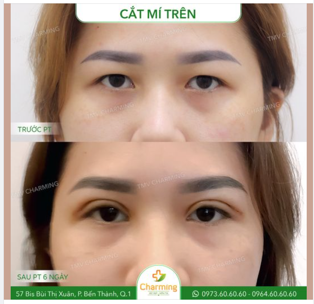 Mắt nàng khách vốn dĩ to nhưng phần mí mắt lại không rõ khiến mắt nàng nhìn như đang trợn trừng, giận dữ với cả thế giới.