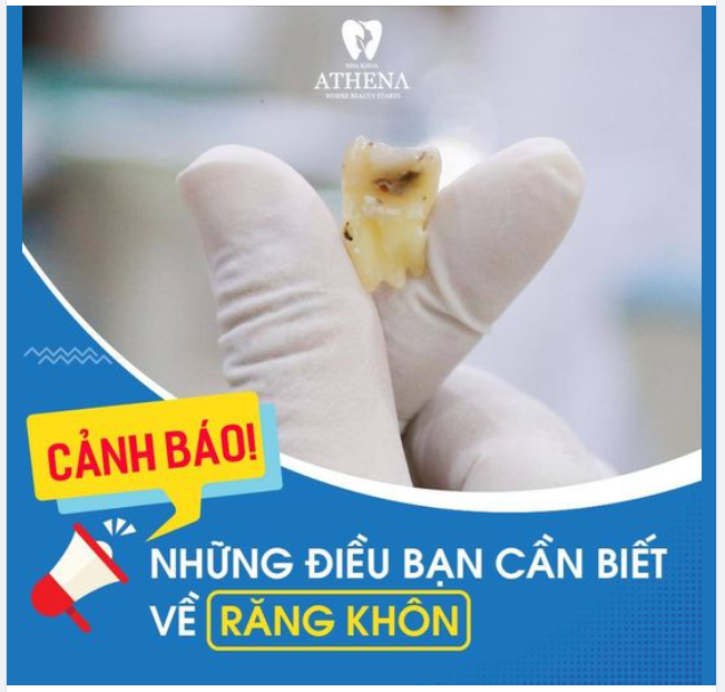 CẢNH BÁO: RĂNG KHÔN VÀ NHỮNG HẬU HỌA KHÓ LƯỜNG