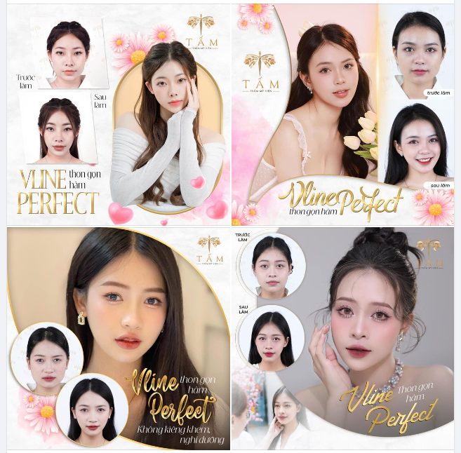 THĂNG HẠNG NHAN SẮC - ĐẸP TRỌN KHOẢNH KHẮC VỚI THON GỌN HÀM VLINE PERFECT