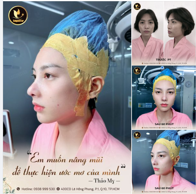 Thảo My chia sẻ về ước mơ với một cuộc thi sắc đẹp, để chuẩn bị cho hành trang của mình, bên cạnh trau dồi về tri thức thì nâng cấp diện mạo bản thân cũng là yếu tố cực kỳ cần thiết.