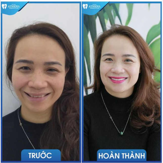"CON VỀ KHOE VỚI CẢ NHÀ LÀ CON CÓ CÔ GIÁO RĂNG ĐẸP LẮM, VỪA TRẮNG VỪA BÓNG, CÔ CƯỜI LÊN RẤT XINH"