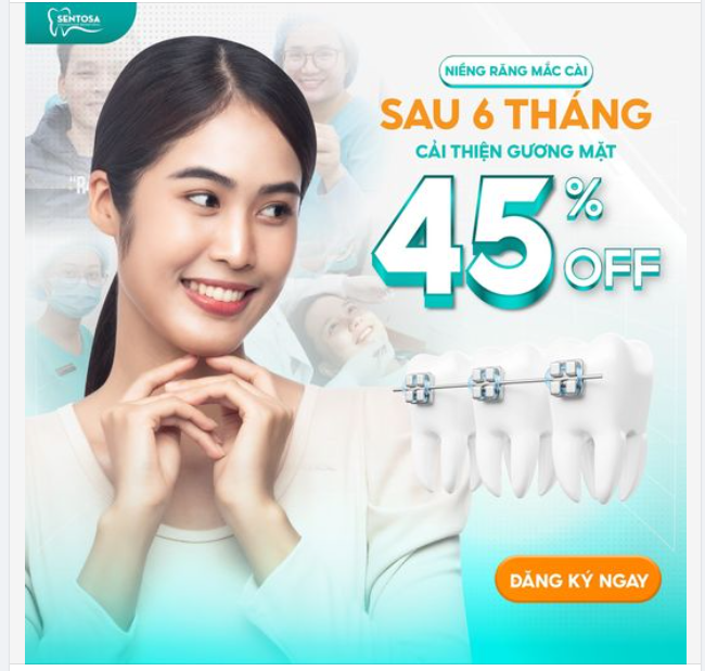 NIỀNG RĂNG MẮC CÀI - SAU 6 THÁNG CẢI THIỆN GƯƠNG MẶT