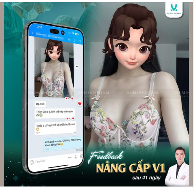 Nạp full năng lượng ngày mới với feedback nâng ngực của chị đẹp tại Dr. Minh Phạm