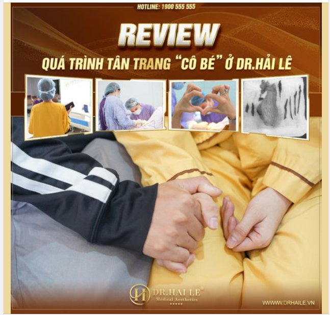 30 phút đi làm lại "cô bé" của em cho chị nào quan tâm. Sinh đẻ rồi lão ck dùng như phá. Rồi mở miệng ra chê nên e quyết tâm đi làm tiếp. Quá trình e đi làm đây :