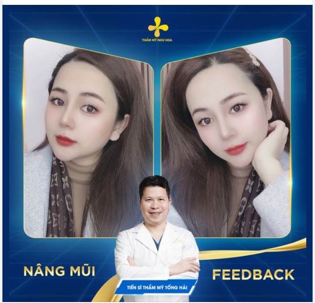 CẬN CẢNH NHAN SẮC TRẺ LÂU VÀ DÁNG MŨI 5 NĂM TUỔI