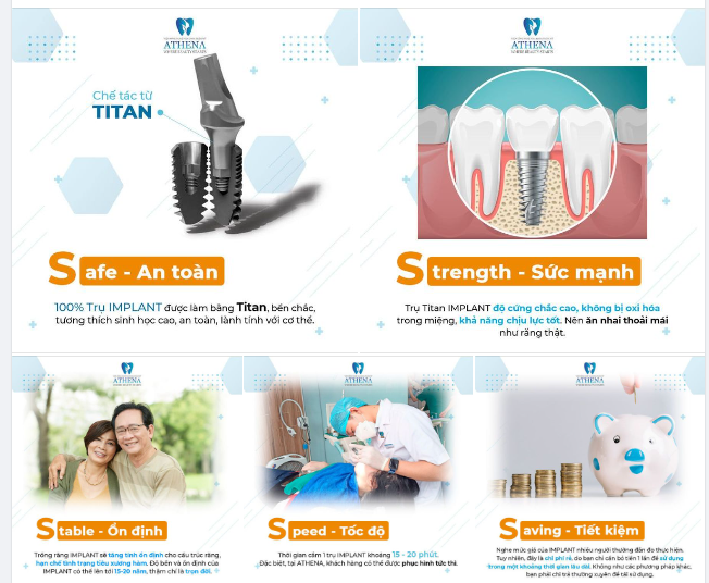 TRỌN ĐỜI ĂN NGON NGỦ KĨ KHI TRỒNG RĂNG IMPLANT 5S TẠI VIỆN CÔNG NGHỆ NHA KHOA THẨM MỸ ATHENA !!!