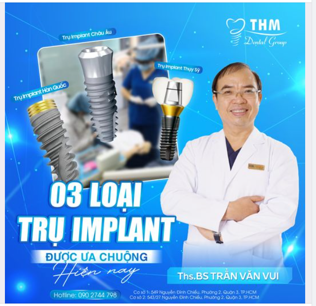 TOP 3 LOẠI TRỤ IMPLANT ĐƯỢC ƯA CHUỘNG NHẤT HIỆN NAY
