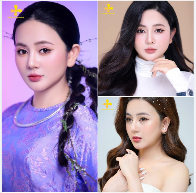 Nếu bạn là thế hệ 9x, 10x yêu thích chụp ảnh chân dung, thì đây là lý do bạn nên “đầu tư” ngay mũi cao - đẹp cho mình.
