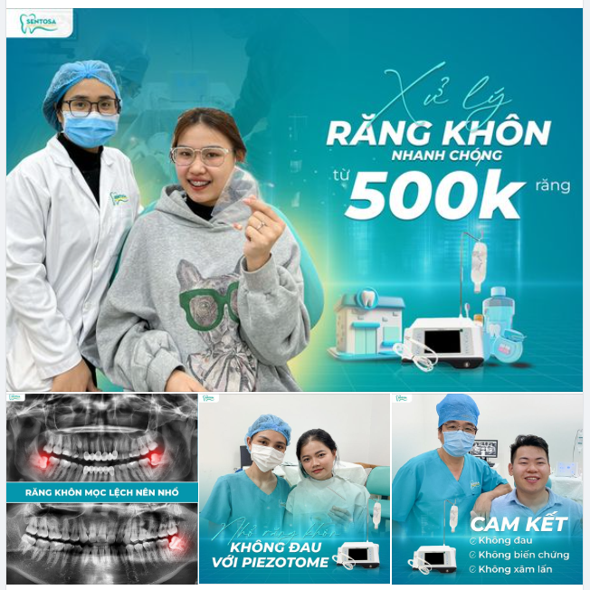 NHỔ RĂNG KHÔN 10 PHÚT BẰNG SÓNG SIÊU ÂM TỪ 500.000Đ/RĂNG