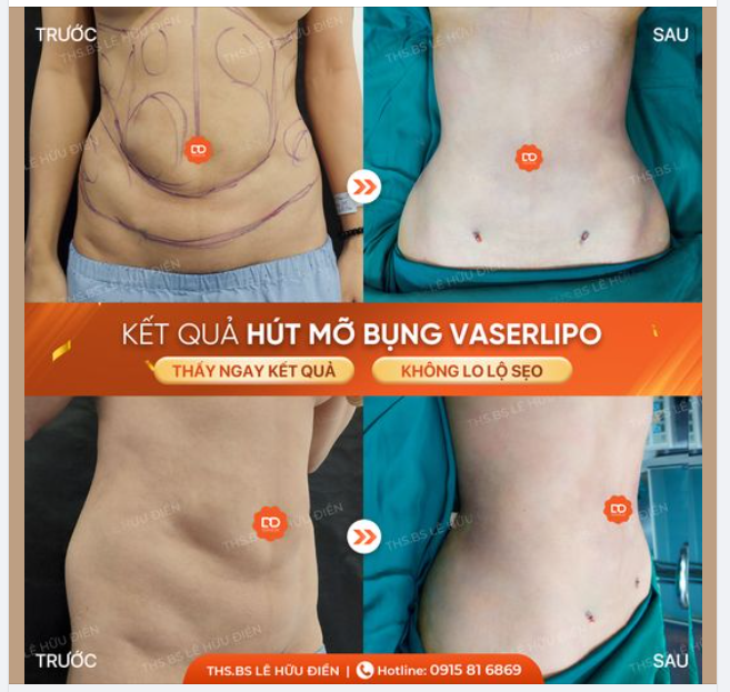 TẠM BIỆT MỠ THỪA - VỪA NGAY SIZE S