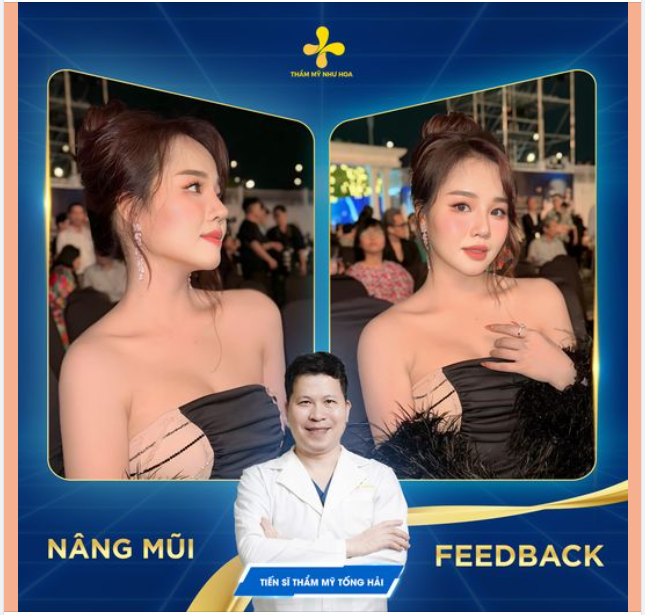 BÍ KÍP TRỞ NÊN NỔI BẬT CỦA CELEB