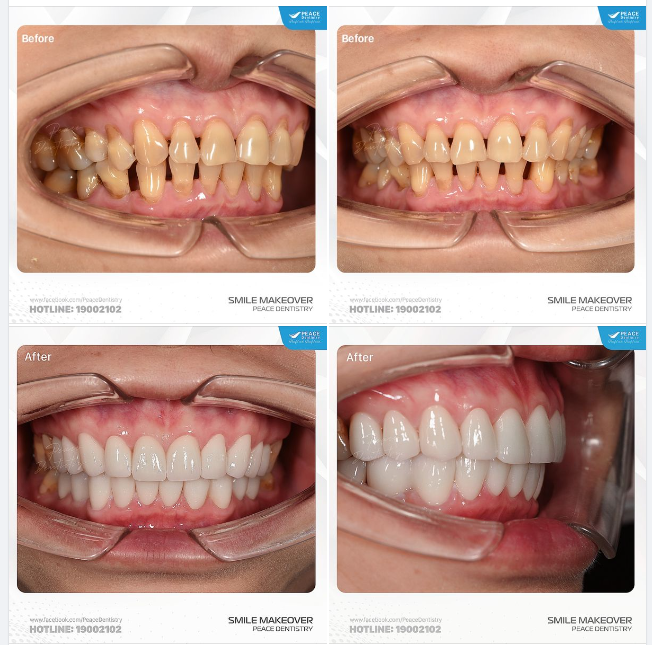 ĐẸP TỰ NHIÊN, KHỎE KHOẮN DÀI LÂU SMILE MAKEOVER