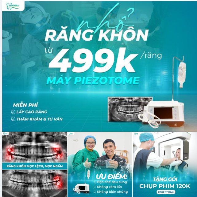 NHỔ RĂNG KHÔN TỪ 499K/RĂNG BẰNG MÁY PIEZOTOME