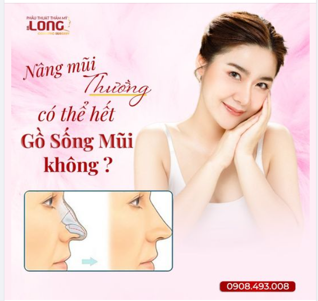 SỐNG MŨI GỒ - NÂNG MŨI LIỆU CÓ HẾT “GỒ”?