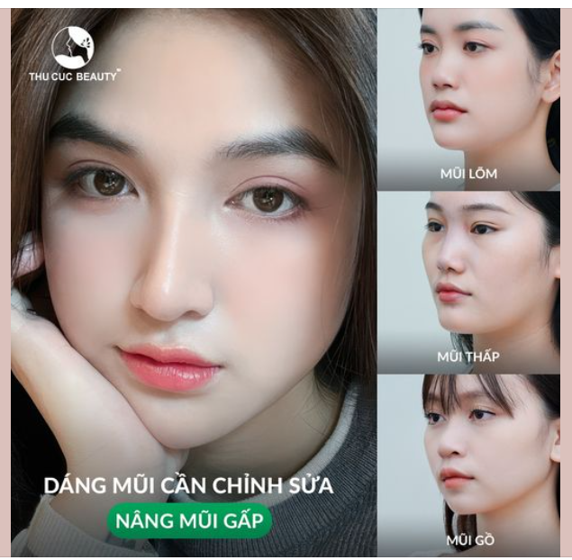 30P sở hữu dáng mũi cao sang, đẹp ngay sau làm Chọn mũi TC