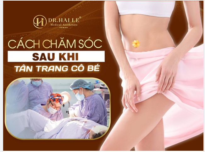 Cách chăm sóc tân trang "cô bé"