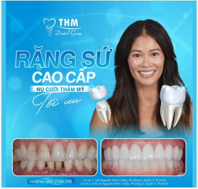 RĂNG SỨ CAO CẤP - NỤ CƯỜI THẨM MỸ TỐI ƯU