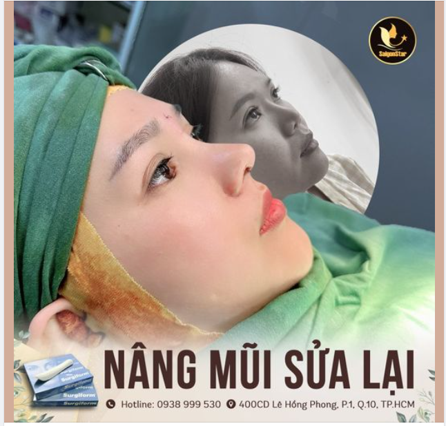 60 PHÚT THAY ĐỔI DÁNG MŨI – ĐỔI LẤY SẮC DIỆN HÀI HÒA