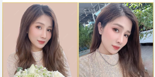 Nhiều Khách hàng có tâm lý lo lắng, băn khoăn sau khi nâng mũi cấu trúc sử dụng sụn tự thân liệu có bị giả, thô cứng, mất tự nhiên