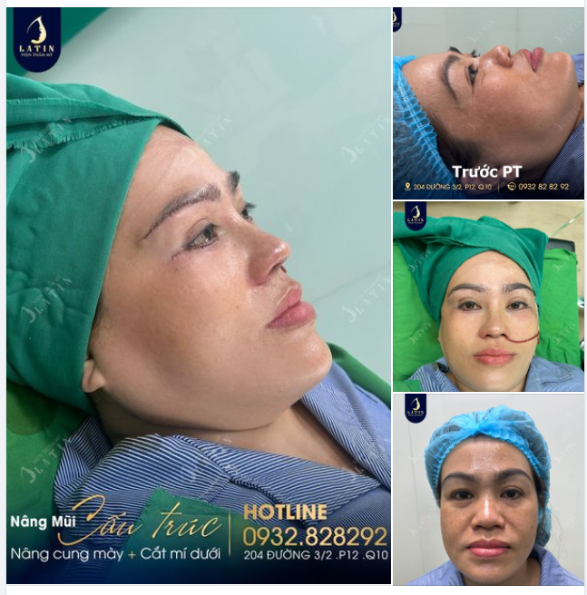 Chị khách muốn thay đổi diện mạo, mong muốn vẻ ngoài xinh đẹp, trẻ trung và cuốn hút hơn.