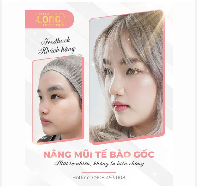 ĐỘ MŨI CAO SANG CHÀO ĐÓN THÁNG CỦA NÀNG