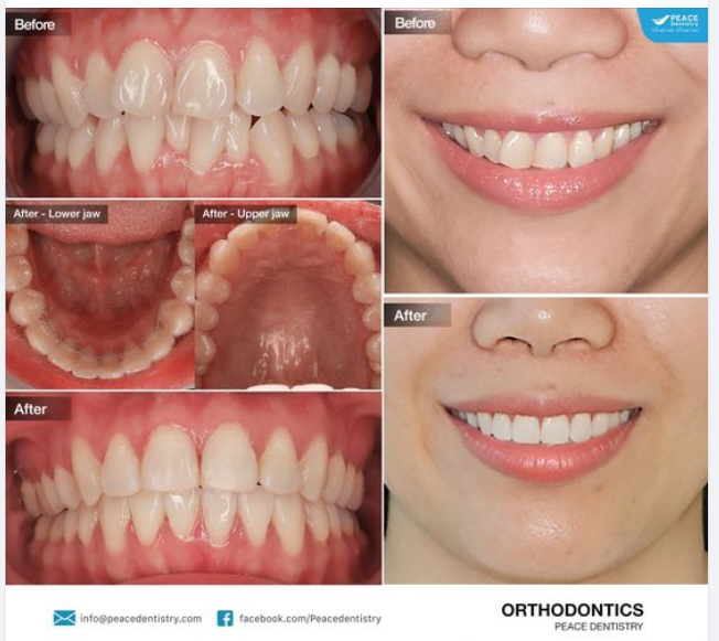 NHỮNG ĐIỀU TỐT ĐẸP THÌ LUÔN CẦN THỜI GIAN