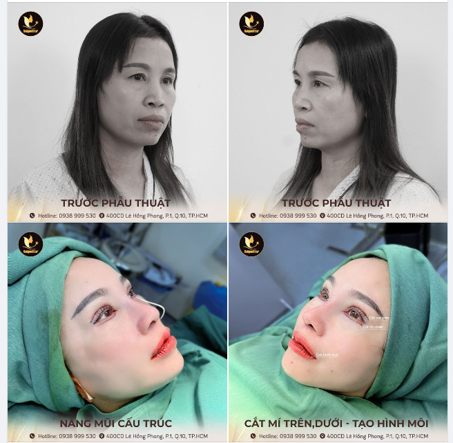 COMBO THAY ĐỔI 360 ĐỘ CHO KHÁCH VIỆT KIỀU ÚC: