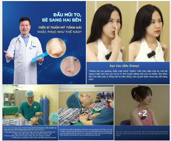 BẠN BỊ ĐẦU MŨI TO, BÈ SANG HAI BÊN... NÊN XEM TỪNG ẢNH DƯỚI ĐÂY