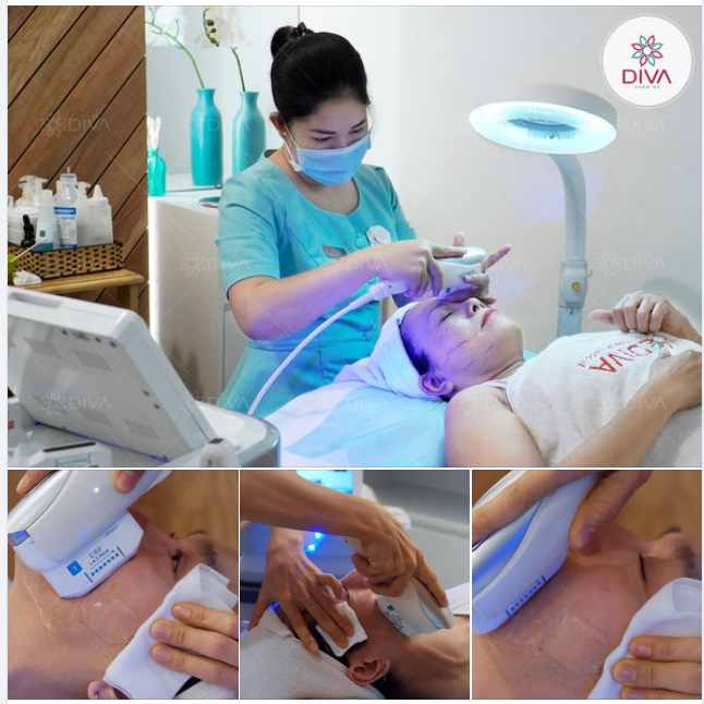 KHI NÀO THÌ NÊN SỬ DỤNG HIFU ĐỂ LÀM SĂN CHẮC DA