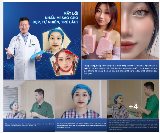 MẮT LỒI: NHẤN MÍ SAO CHO ĐẸP, TỰ NHIÊN, TRẺ LÂU?