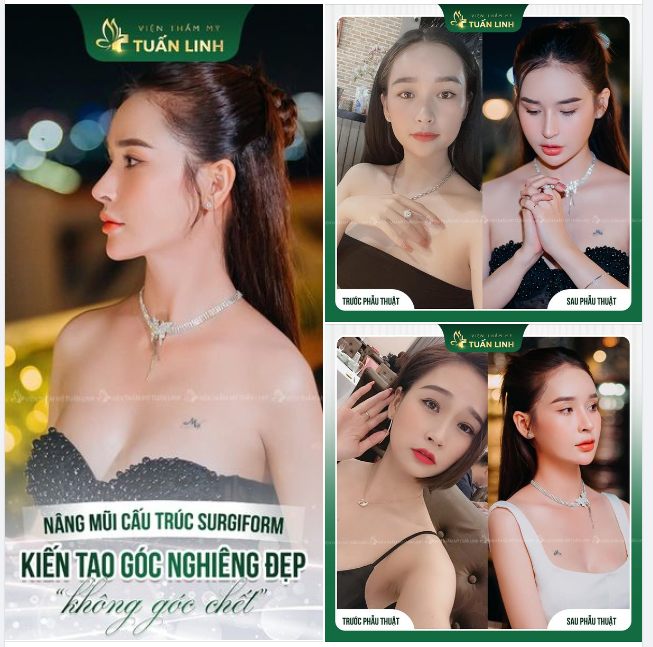 Kiến tạo góc nghiêng đẹp ''không góc chết"!!