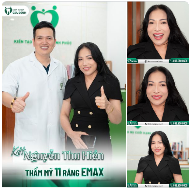 NỤ CƯỜI THAY ĐỔI THẦN THÁI NGAY CẢ KHI CHỈ THẨM MỸ RĂNG HÀM TRÊN
