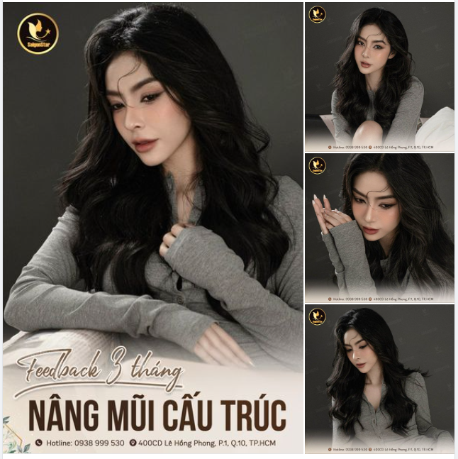 FEEDBACK 3 THÁNG NÂNG MŨI CẤU TRÚC