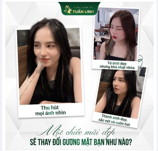 Xinh đẹp X3000 lần nhờ chiếc mũi cao thanh tú!!