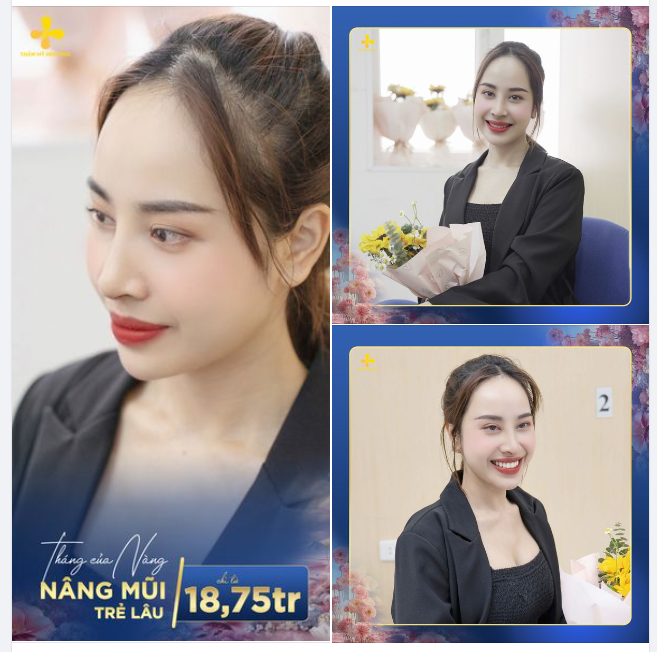 F5 bản thân bằng dáng mũi mới - Chỉ từ 18,75 triệu. Áp dụng đến ngày 15/3/2024