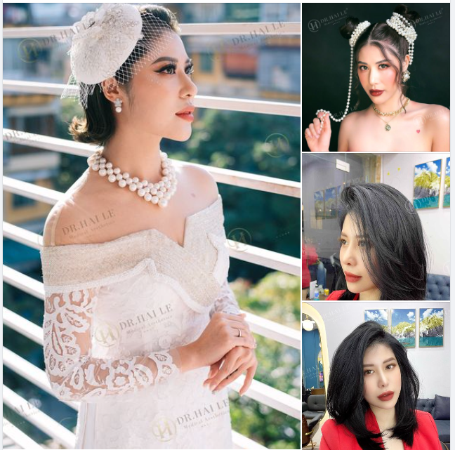 Thăng hạng nhan sắc ngay hôm nay với chiếc cằm V-line thanh tú kèm mức giá siêu hời khi đặt lịch trong 2 ngày vàng 8-9/3/2024 chị em nhé!