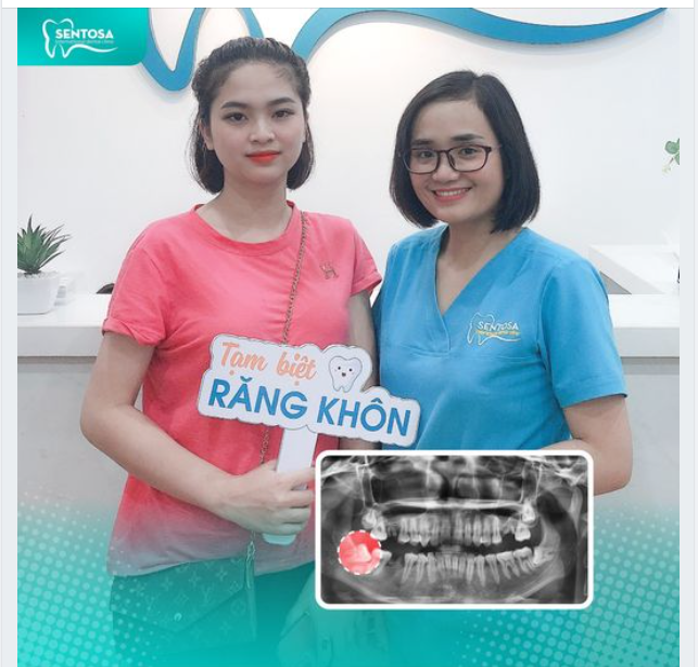 Răng khôn mọc lệch, làm sâu răng, xê dịch răng…
