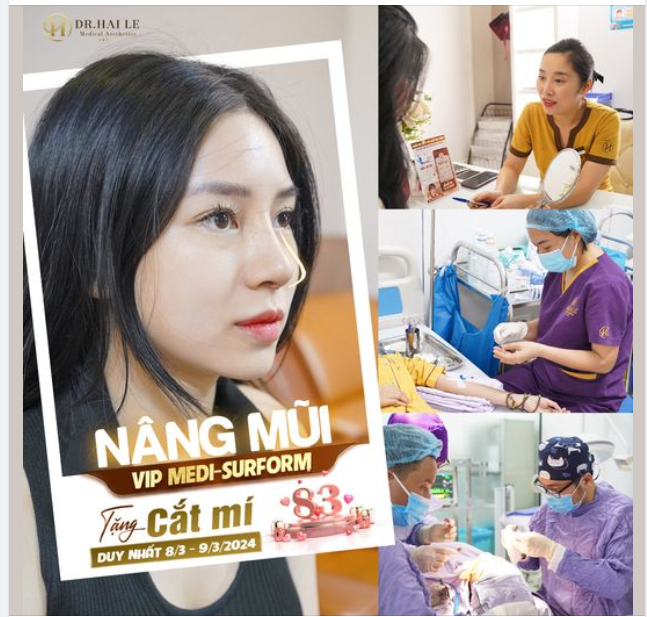 Nâng mũi VIP Medi- Surform tặng ngay cắt mí