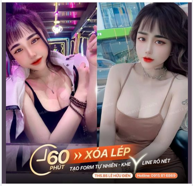 FORM TỰ NHIÊN - KHE RÕ NÉT