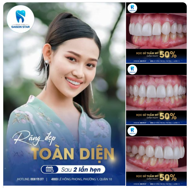RĂNG ĐẸP TOÀN DIỆN – CHẲNG NGẠI CƯỜI TƯƠI GIẢM 50% - TẶNG QUÀ TRỊ GIÁ 3 TRIỆU
