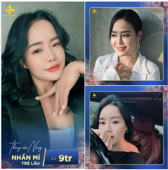 Nếp mí tự nhiên giúp chị em duy trì nhan sắc trẻ lâu.