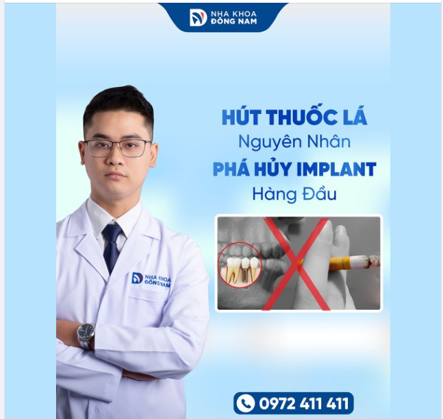 KIÊNG THUỐC LÁ - LƯU Ý QUAN TRỌNG TRƯỚC VÀ SAU KHI CẤY IMPLANT