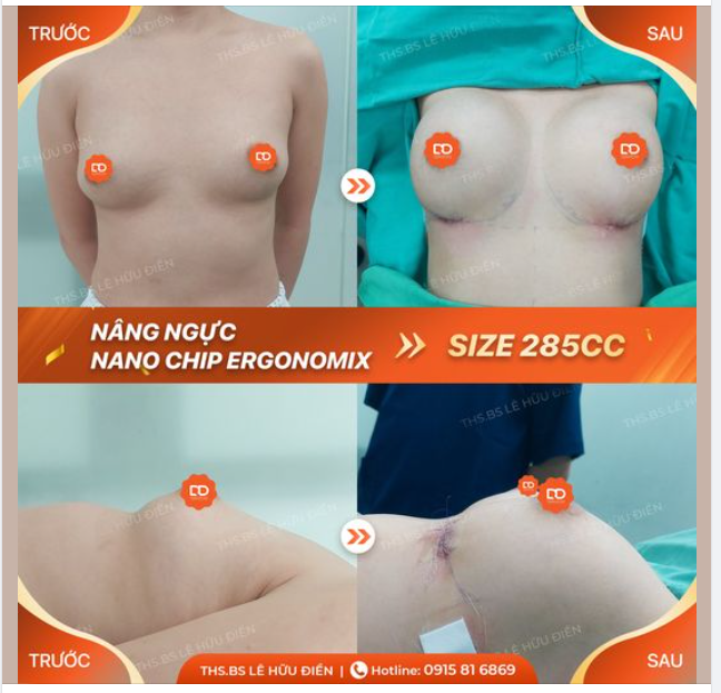 TEO LÉP CỠ NÀO CŨNG HOÁ CĂNG TRÒN HẾT CỠ